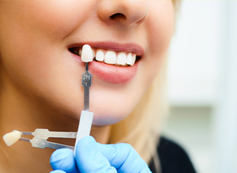 Woman's smile compared with tooth color chart