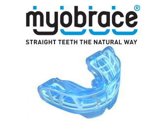 Myobrace appliance