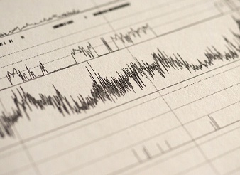 sleep apnea test read out