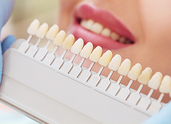 Closeup of smile compared with tooth color chart